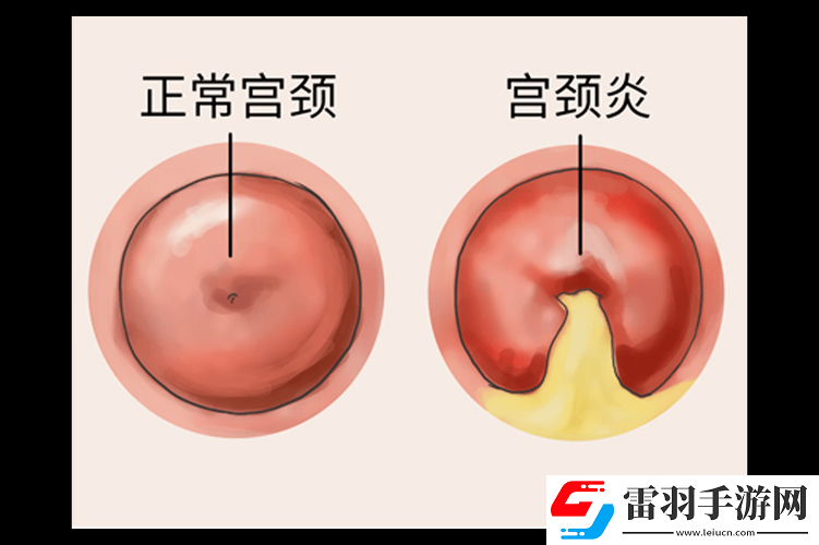 啪啪頂?shù)阶罾锩媪餮闆r是否常見及相關(guān)探討
